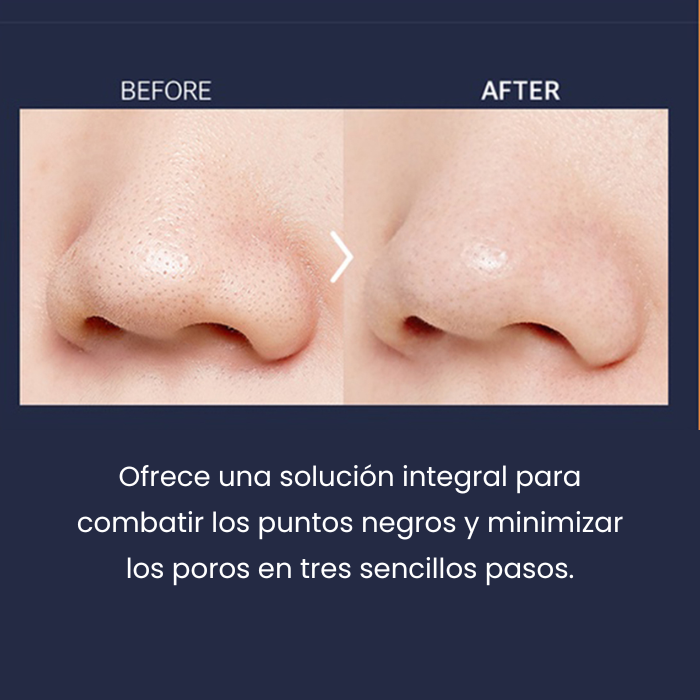 A'PIEU Goblin Blackhead 3-Step Nose Pack