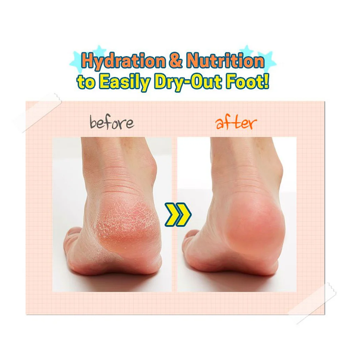A'pieu Soft Foot 30Minute Peeling Socks