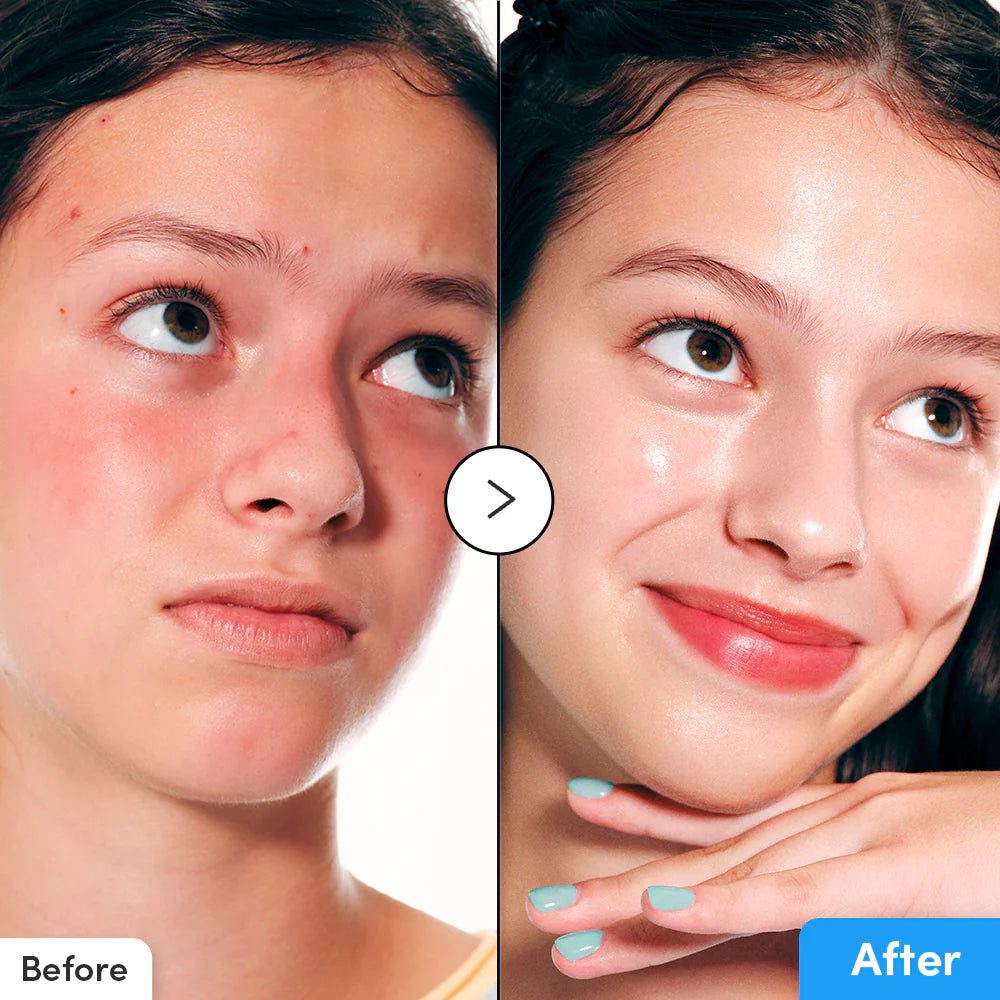 EQQUALBERRY_Hyaltoin_Flooding_Serum