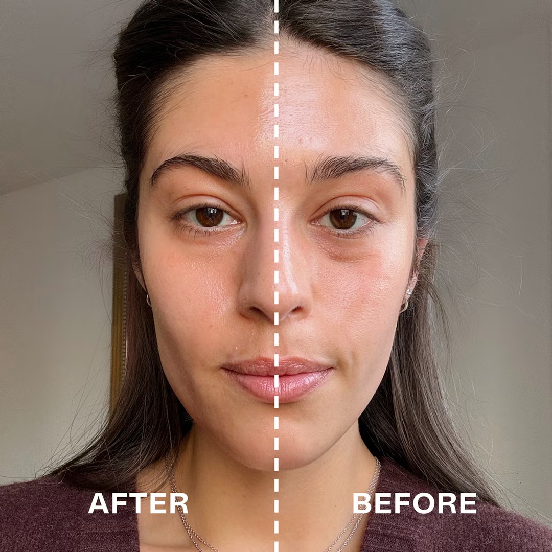 Medicube - AGE-R Booster Pro Purple Edition