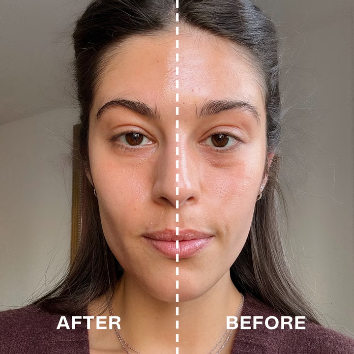 Medicube - AGE-R Booster Pro Purple Edition