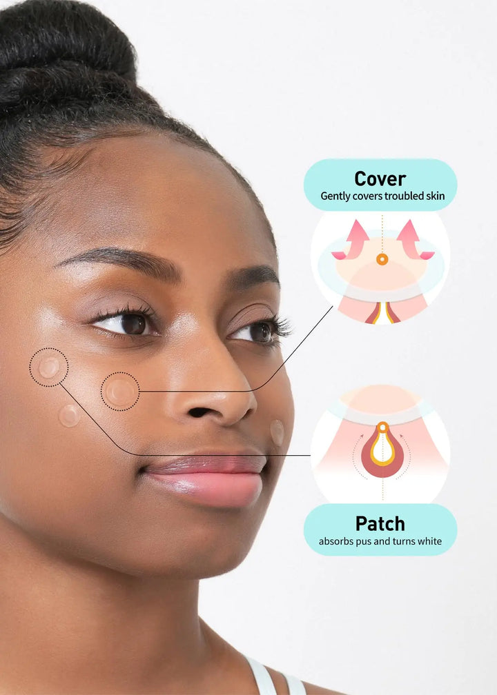 OLIVE YOUNG Care Plus Spot Cover Patch Calming