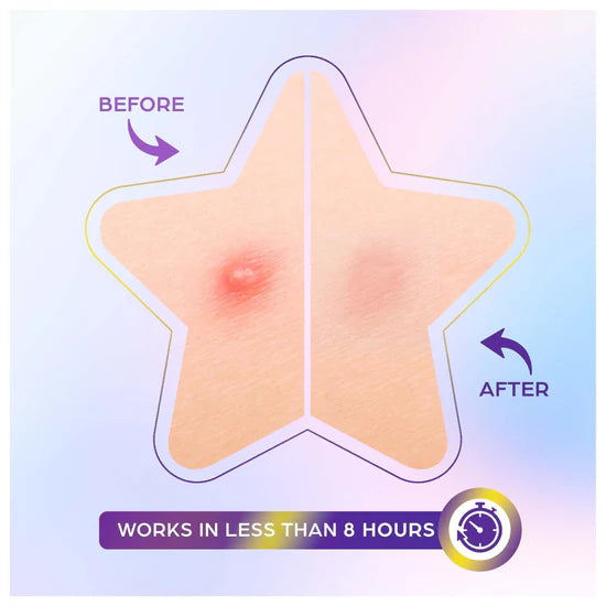 OOTD BEAUTY OOTD Star Spot Patch 80 patches