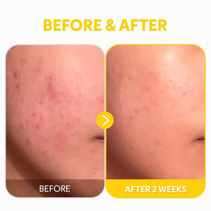 TIRTIR Pure Vitamin C 24% Serum